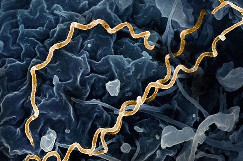 Dotyk | Odkud se rozšířil syfilis? Lidé se nakazili pohlavní nemocí mnohem dříve, než se myslelo, uvedl tým vědců