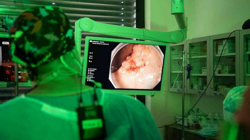 Olomoucká fakultka zvýšila počty preventivní kolonoskopie, díky novým přístrojům